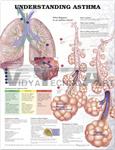 Understanding Asthma Anatomical Chart - Laminated